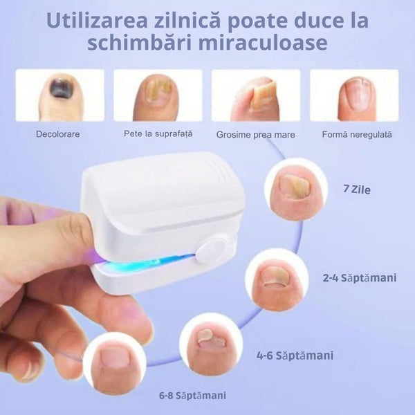 Lampa Magică Anti-Fungică